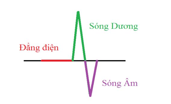 Đại cương về đo điện tâm đồ